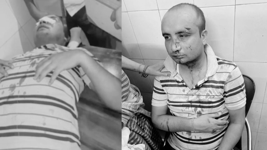कानपुर देहात के मंगलपुर थाना क्षेत्र में जमीनी विवाद ने एक बार फिर हिंसक...
