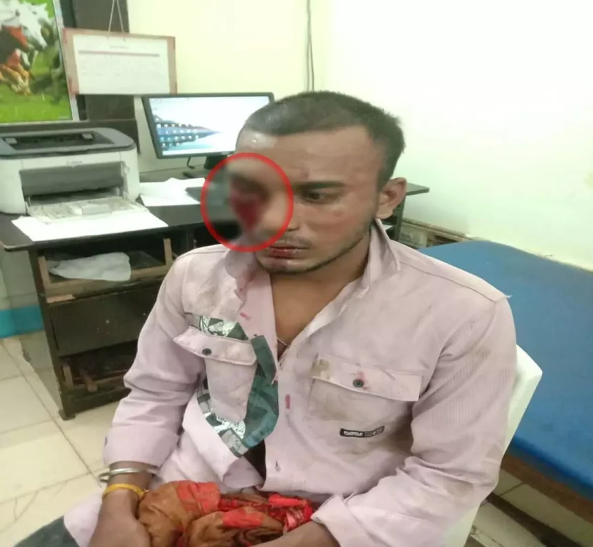 Raipur Breaking: बहन से बात क्यों करते हो कहकर युवक की बेरहमी से पिटाई, देखें VIDEO...