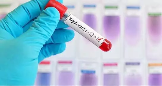 निपाह वायरस की दस्तक के बाद पड़ोसी राज्य सतर्क