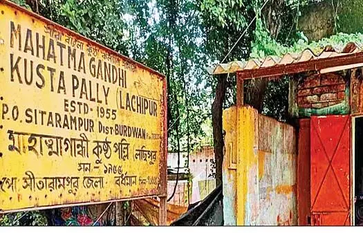 कुष्ठ रोग के कारण उनकी एक उंगली चली गई और उन्हें राशन और आधार कार्ड पाने में परेशानी हो रही