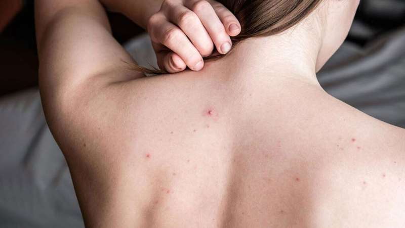 पीठ के दाने-फुंसियों से परेशान? नहाते वक्त अपनाएं ये आसान तरीका, मिलेगा क्लियर बैक