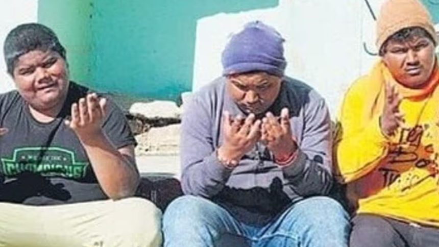 उत्तराखंड के नैनीताल जिले में तीन भाई ‘लॉरेंस मून बेडिल सिंड्रोम’ जैसी...